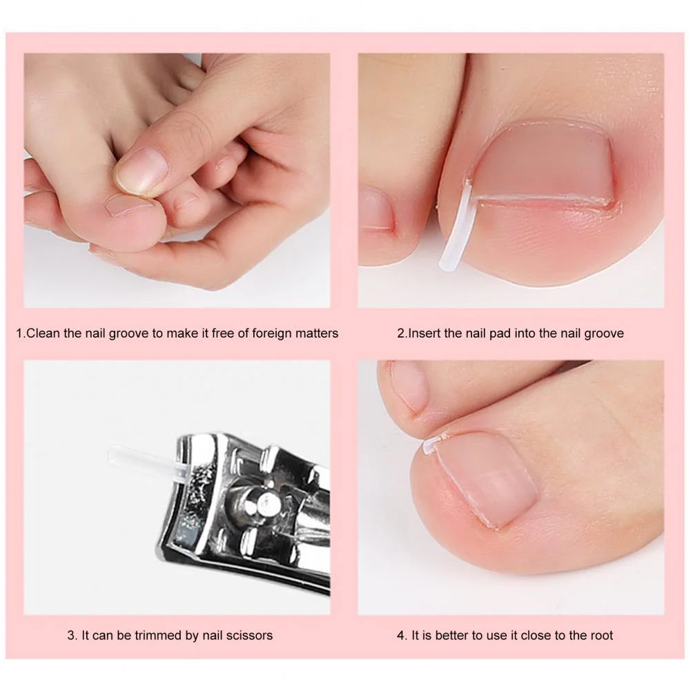 Toe Nail Support Pad - Image 3