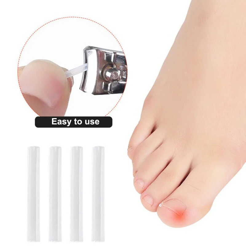 Toe Nail Support Pad - Image 2