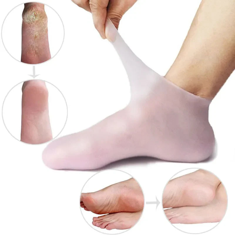 Skin Moisturizing Gel Foot Care Socks - Image 1