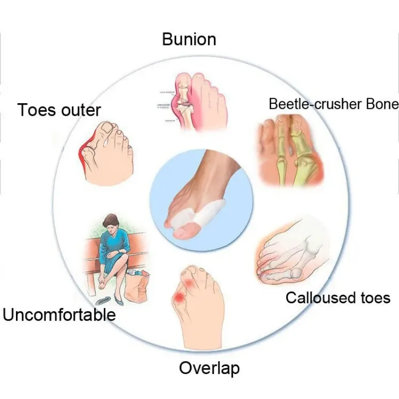 Toe Separator Silicone Gel Orthopaedic Foot Corrector - Image 2
