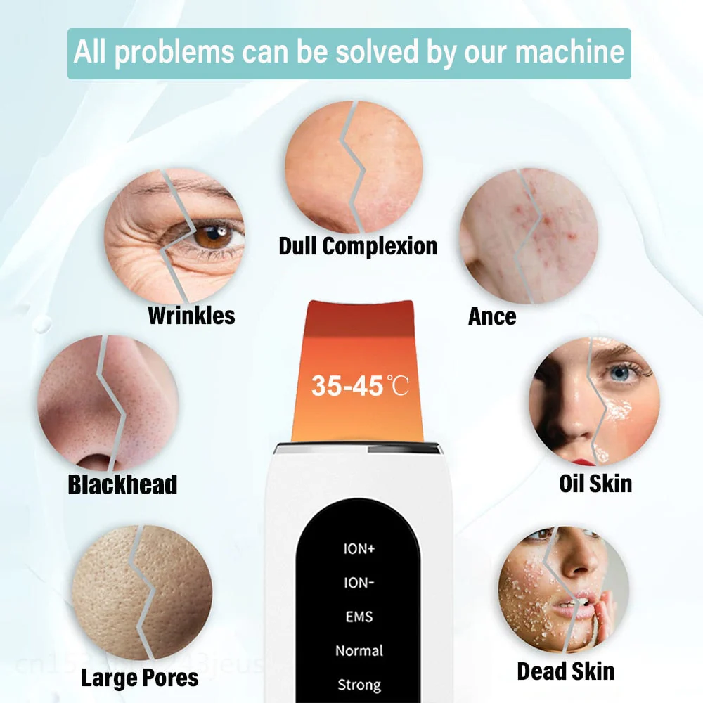 Deep Face Cleaning Ultrasonic Facial Cleanser - Image 3